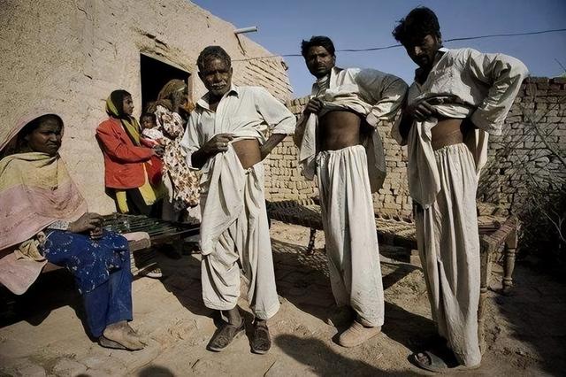 人的一個腎能值多少錢插圖2